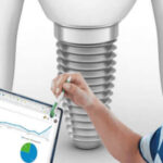 A man is holding a pen in his hand and pointing marketing statistics on a laptop with pen, dental implant is there in the background.